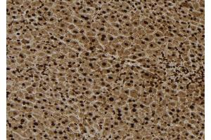ABIN6279049 at 1/100 staining Mouse liver tissue by IHC-P. (RPL4 抗体  (Internal Region))
