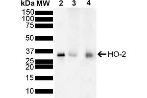 Western blot analysis of Mouse, Rat Brain showing detection of ~36 kDa HO-2 protein using Rabbit Anti-HO-2 Polyclonal Antibody (ABIN5696131). (HMOX2 抗体  (FITC))