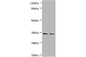 Western blot All lanes: Killer cell immunoglobulin-like receptor 2DS4 antibody at 4 μg/mL Lane 1: K562 whole cell lysate Lane 2: Jurkat whole cell lysate Secondary Goat polyclonal to rabbit IgG at 1/10000 dilution Predicted band size: 34 kDa Observed band size: 34 kDa (KIR2DS4 抗体  (AA 22-245))