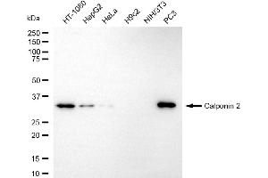 Western blotting analysis using calponin 2 antibody (ABIN7797852). (CNN2 抗体)