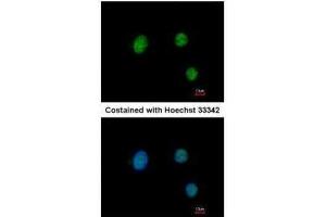 ICC/IF Image Immunofluorescence analysis of paraformaldehyde-fixed HeLa, using PAX9, antibody at 1:200 dilution. (PAX9 抗体)