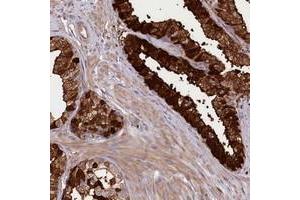 Immunohistochemical staining of human prostate with KIAA1731 polyclonal antibody  shows strong cytoplasmic and membranous positivity in glandular cells at 1:200-1:500 dilution. (KIAA1731 (KIAA1731) 抗体)