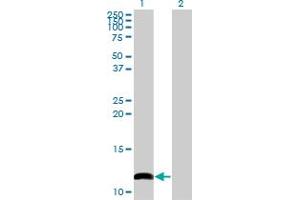 Western Blot analysis of COX6B1 expression in transfected 293T cell line by COX6B1 monoclonal antibody (M02), clone 2D3. (COX6B1 抗体  (AA 1-86))