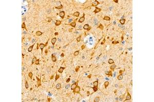 Immunohistochemistry of paraffin embedded mouse brain using NECAB1 (ABIN7074753) at dilution of 1: 5000 (400x lens)