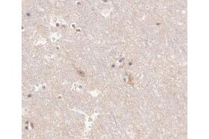 ABIN6266625 at 1/100 staining human brain tissue sections by IHC-P. (KCNC2 抗体  (C-Term))