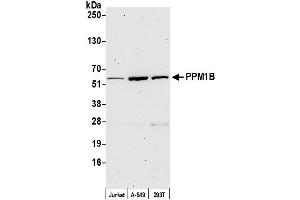 anti-Protein Phosphatase, Mg2+/Mn2+ Dependent, 1B (PPM1B) (C-Term) antibody