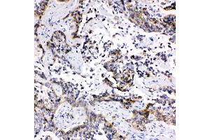 Immunohistochemistry (IHC) image for anti-ATP-Binding Cassette, Sub-Family C (CFTR/MRP), Member 1 (ABCC1) (AA 1514-1531), (C-Term) antibody (ABIN3044230)