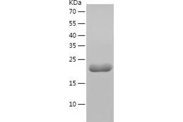 LIN28A Protein (AA 3-182) (His tag)