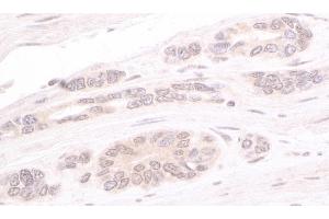Immunohistochemistry (IHC) image for anti-ATR Interacting Protein (ATRIP) (AA 100-150) antibody (ABIN7453575) (ATRIP 抗体  (AA 100-150))