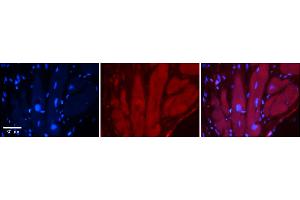 Immunohistochemistry (IHC) image for anti-Transient Receptor Potential Cation Channel, Subfamily V, Member 4 (TRPV4) (N-Term) antibody (ABIN2776241)
