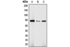 Western blot analysis of DBF4 expression in Jurkat (A), HepG2 (B), SW480 (C) whole cell lysates. (DBF4 抗体  (N-Term))