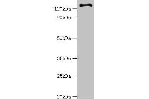 Western blot All lanes: RET antibody at 6 μg/mL + Hela whole cell lysate Secondary Goat polyclonal to rabbit IgG at 1/10000 dilution Predicted band size: 125, 120 kDa Observed band size: 125 kDa