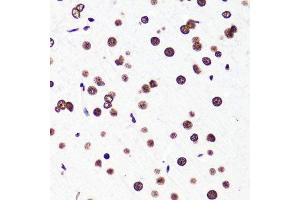 Immunohistochemistry (Paraffin-embedded Sections) (IHC (p)) image for anti-Histone 3 (H3) (H3K36me2) antibody (ABIN3016036)