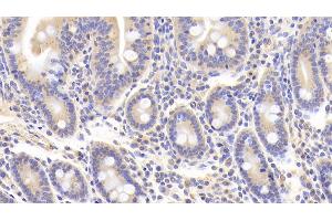 Immunohistochemistry (IHC) image for anti-Noggin (NOG) (AA 28-232) antibody (ABIN7434698)