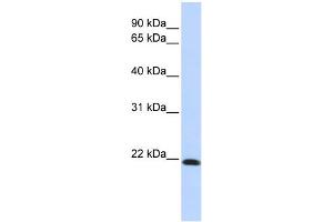 WB Suggested Anti-CLDN7 Antibody Titration:  0. (Claudin 7 抗体  (Middle Region))