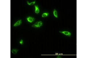 Immunofluorescence of monoclonal antibody to TPMT on HeLa cell. (TPMT 抗体  (AA 1-245))
