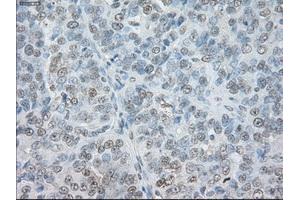 Immunohistochemical staining of paraffin-embedded Ovary tissue using anti-SORDmouse monoclonal antibody. (SORD 抗体)