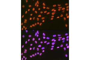 Immunofluorescence analysis of C6 cells using EWSR1 Rabbit mAb (ABIN7267053) at dilution of 1:100 (40x lens). (EWSR1 抗体)