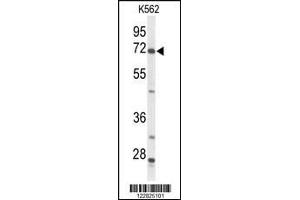Western blot analysis of ACSS2 Antibody in K562 cell line lysates (35ug/lane) (ACSS2 抗体  (N-Term))