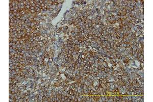 Image no. 1 for anti-Clathrin, Light Chain B (CLTB) (AA 1-212) antibody (ABIN598618) (CLTB 抗体  (AA 1-212))