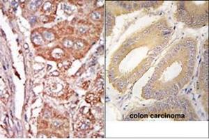 Image no. 1 for anti-Fibroblast Growth Factor 4 (FGF4) (C-Term) antibody (ABIN360661) (FGF4 抗体  (C-Term))