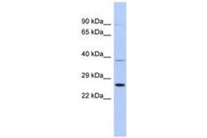Image no. 1 for anti-SAR1 Homolog B (SAR1B) (AA 107-156) antibody (ABIN6744023) (SAR1B 抗体  (AA 107-156))