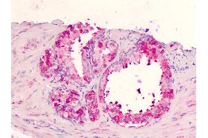 Human Prostate: Formalin-Fixed, Paraffin-Embedded (FFPE) (GPR183 抗体  (Extracellular Domain))