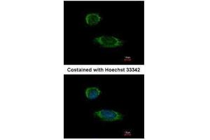 ICC/IF Image Immunofluorescence analysis of methanol-fixed HeLa, using Caspase 1 alpha, antibody at 1:500 dilution. (Caspase 1 抗体)