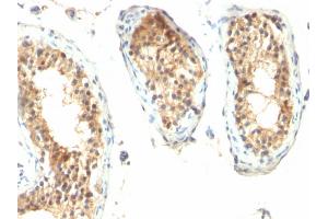 Immunohistochemistry (IHC) image for anti-Ornithine Decarboxylase 1 (ODC1) antibody (ABIN6940235)