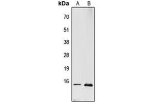 Western blot analysis of RPL22 expression in PC12 (A), MCF7 (B) whole cell lysates. (RPL22 抗体  (Center))