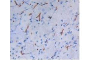 IHC-P analysis of Mouse Brain Tissue, with DAB staining. (Albumin 抗体)