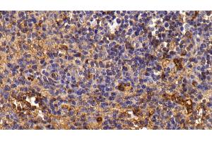 Detection of TF in Porcine Lymph node Tissue using Polyclonal Antibody to Transferrin (TF) (Transferrin 抗体)