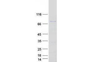 Western Blotting (WB) image for Spire Homolog 1 (Drosophila) (SPIRE1) (Transcript Variant 2) protein (Myc-DYKDDDDK Tag) (ABIN2732604)