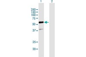 Western Blot analysis of GTF2E1 expression in transfected 293T cell line by GTF2E1 MaxPab polyclonal antibody. (GTF2E1 抗体  (AA 1-439))
