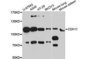 Western blot analysis of extracts of various cell lines, using CDH11 antibody. (OB Cadherin 抗体)