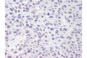 anti-Achaete-Scute Complex Homolog 2 (ASCL2) (C-Term) antibody