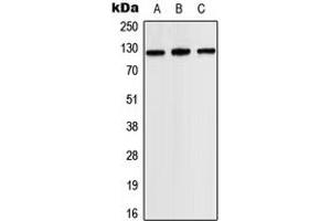 Western blot analysis of JAK2 expression in HEK293T (A), SP2/0 (B), H9C2 (C) whole cell lysates. (JAK2 抗体  (Center))