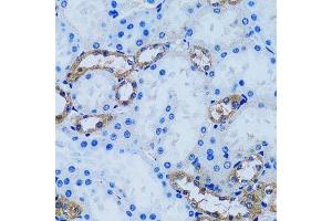 Immunohistochemistry (Paraffin-embedded Sections) (IHC (p)) image for anti-Inositol(myo)-1(or 4)-Monophosphatase 1 (IMPA1) (AA 1-277) antibody (ABIN6142429)