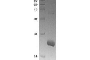 Validation with Western Blot (BCL2L2 蛋白)