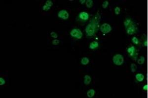 Anti-TP53 mouse monoclonal antibody (ABIN2454591) immunofluorescent staining of COS7 cells transiently transfected by pCMV6-ENTRY TP53 (RC200003). (p53 抗体)