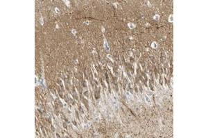 Immunohistochemical staining of human hippocampus with MAGI3 polyclonal antibody  shows mocerate cytoplasmic positivity in neuronal cells and neuropil at 1:20-1:50 dilution.