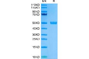 Human CYTL1/C17 on Tris-Bis PAGE under reduced condition. (CYTL1 Protein (AA 23-136) (Fc Tag))
