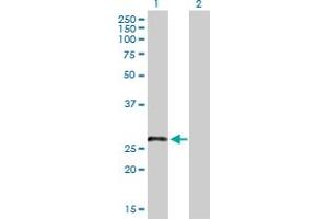 Western Blot analysis of LRRN4CL expression in transfected 293T cell line by LRRN4CL MaxPab polyclonal antibody. (LRRN4CL 抗体  (AA 1-238))