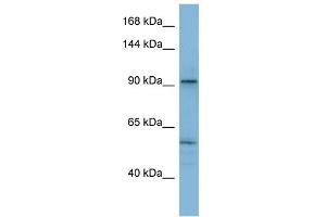 WB Suggested Anti-ATP2A1 Antibody Titration:  0. (ATP2A1/SERCA1 抗体  (N-Term))