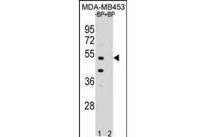 Western blot analysis of WDR51B Antibody Pab pre-incubated without(lane 1) and with(lane 2) blocking peptide in MDA-MB453 cell line lysate. (POC1B 抗体  (C-Term))
