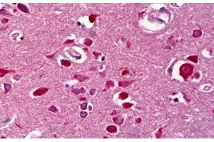 Anti-WISP2 antibody IHC staining of human brain, cortex. (WISP2 抗体)