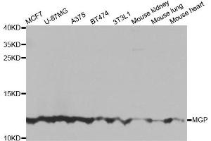 Western blot analysis of extracts of various cell lines, using MGP antibody. (MGP 抗体)