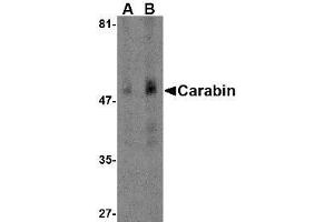 Western blot analysis of Carabin in human spleen tissue lysate with AP30182PU-N Carabin antibody at (A) 1 and (B) 2 μg/ml. (Carabin 抗体  (N-Term))