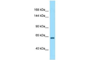 Western Blotting (WB) image for anti-Ras Association and DIL Domains (Radil) (C-Term) antibody (ABIN2789579) (Radil 抗体  (C-Term))
