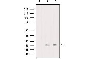 Western blot analysis of extracts from various samples, using Caveolin 1 Antibody.
